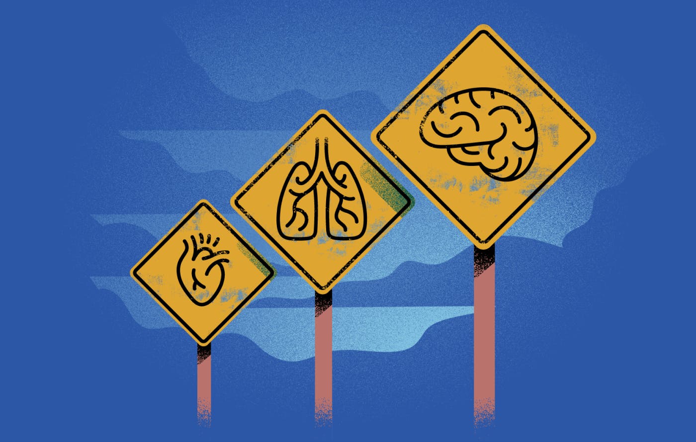 Bouncing forward with resilience